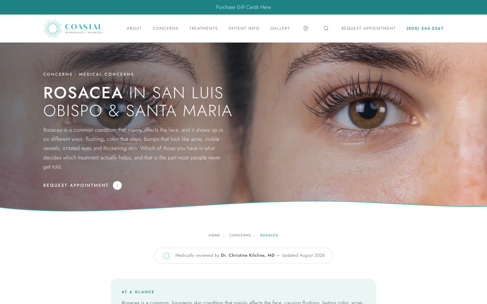 The rosacea condition page: an extreme close-up portrait under the title Rosacea in San Luis Obispo and Santa Maria.