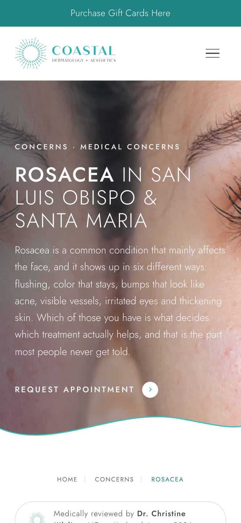 The rosacea condition page on a phone.