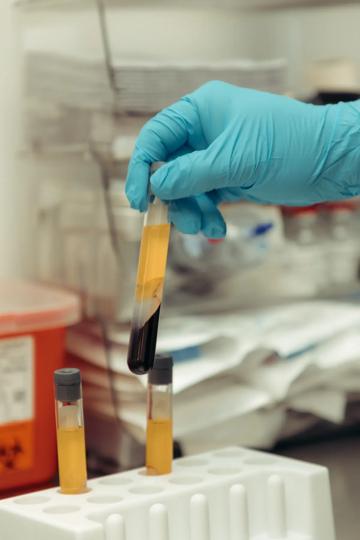 A processed blood sample held up in the lab.