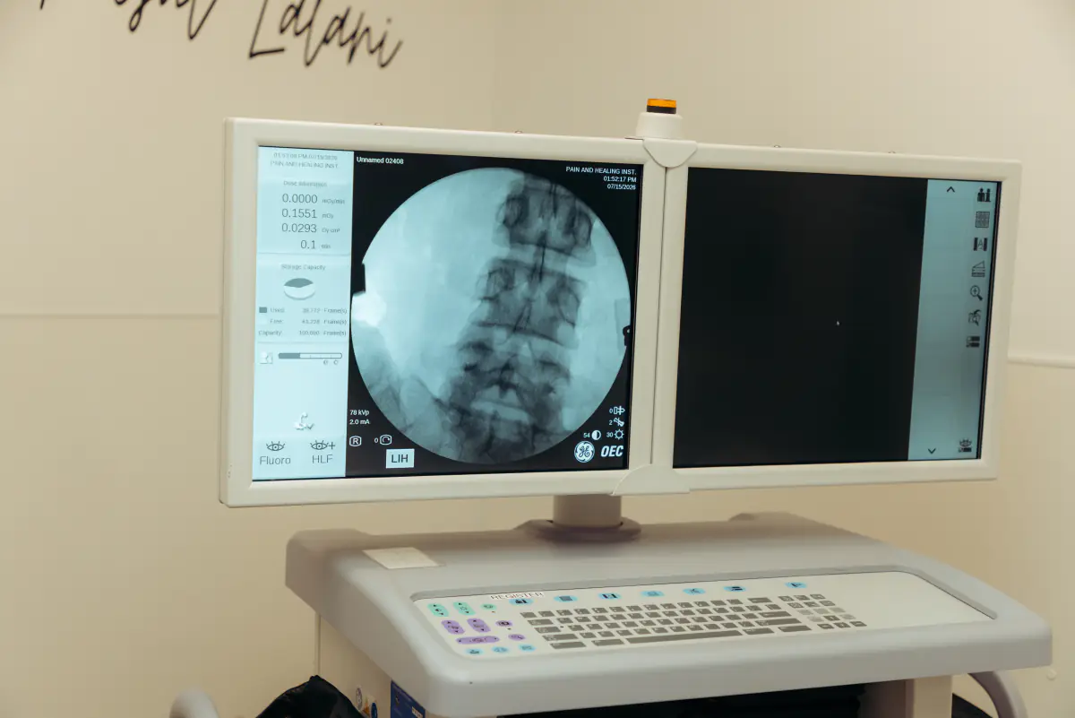 Fluoroscopy imaging monitors in the procedure suite.